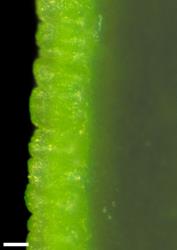 Veronica mooreae. Leaf margin. Scale = 0.1 mm.
 Image: W.M. Malcolm © Te Papa CC-BY-NC 3.0 NZ